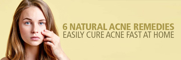 6 Natural Acne Remedies