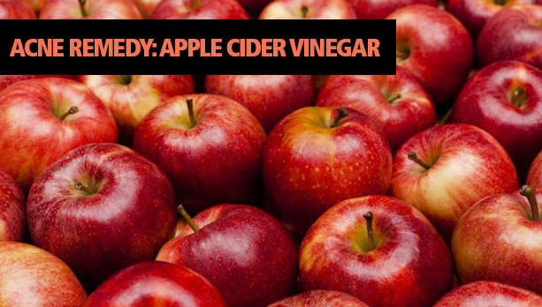 Acne Remedy Apple Cider Vinegar