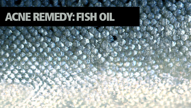 Acne Remedy Fish Oil