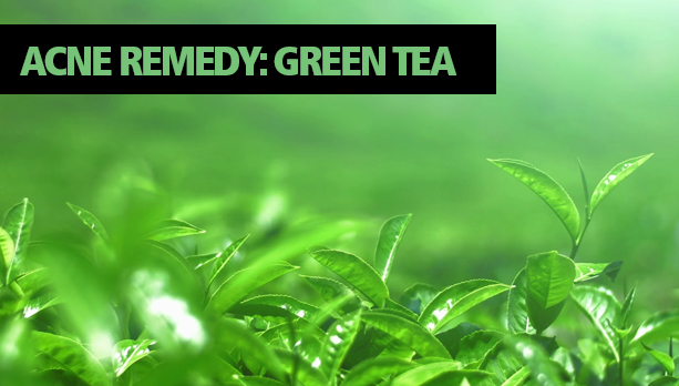Acne Remedy Green Tea