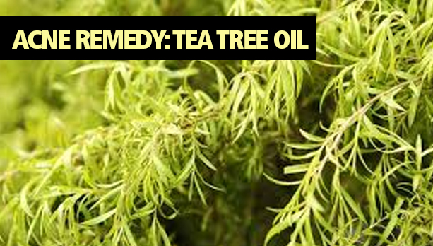 Acne Remedy Tea Tree Oil