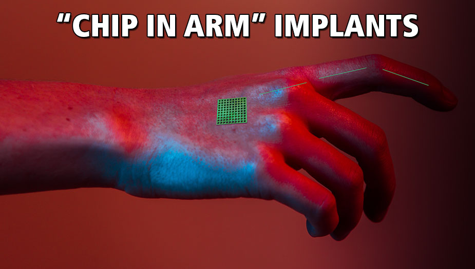 Biohacking Implants